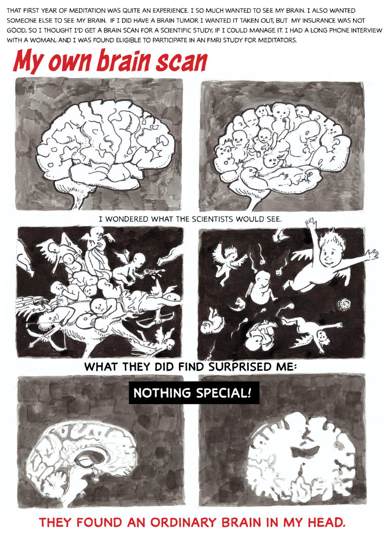 brain
scan